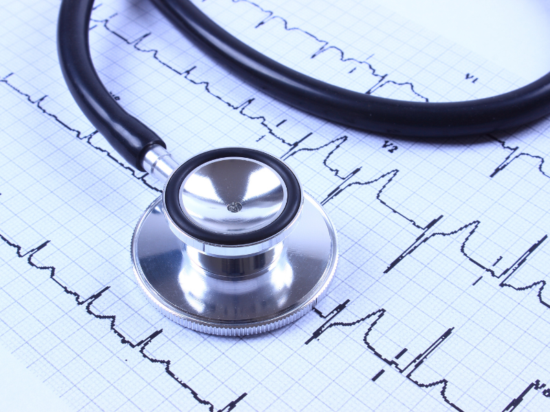 como fazer eletrocardiograma diagnóstico
