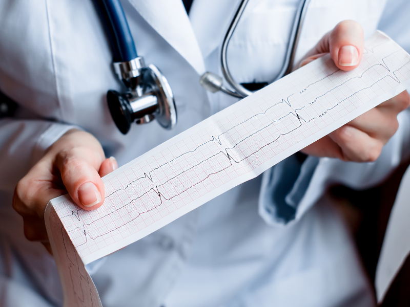 como fazer eletrocardiograma interpretação