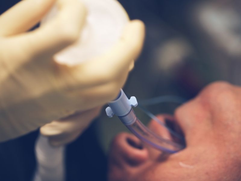intubação orotraqueal pediatria gerenciamento