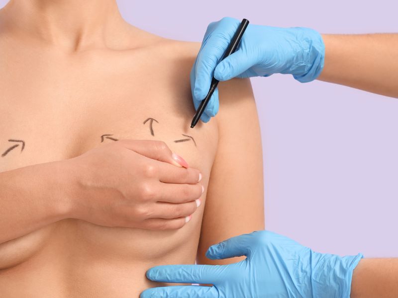 dr de são paulo bom em mamoplastia redutora e relação