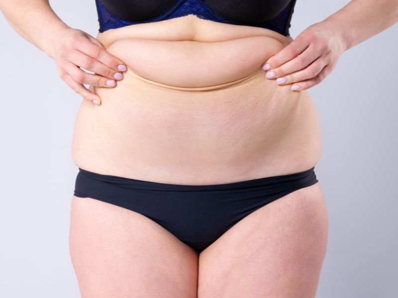 melhor clínica de abdominoplastia em São Paulo - critérios