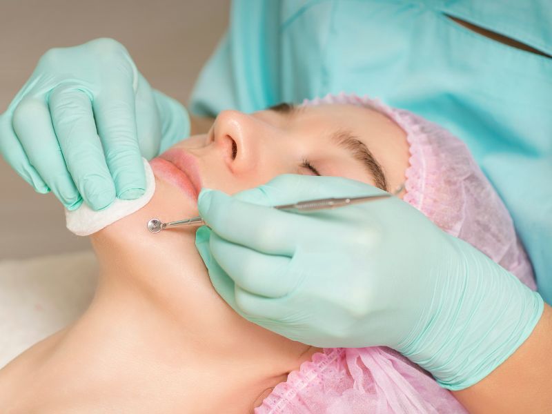 quanto custa limpeza de pele - fatores