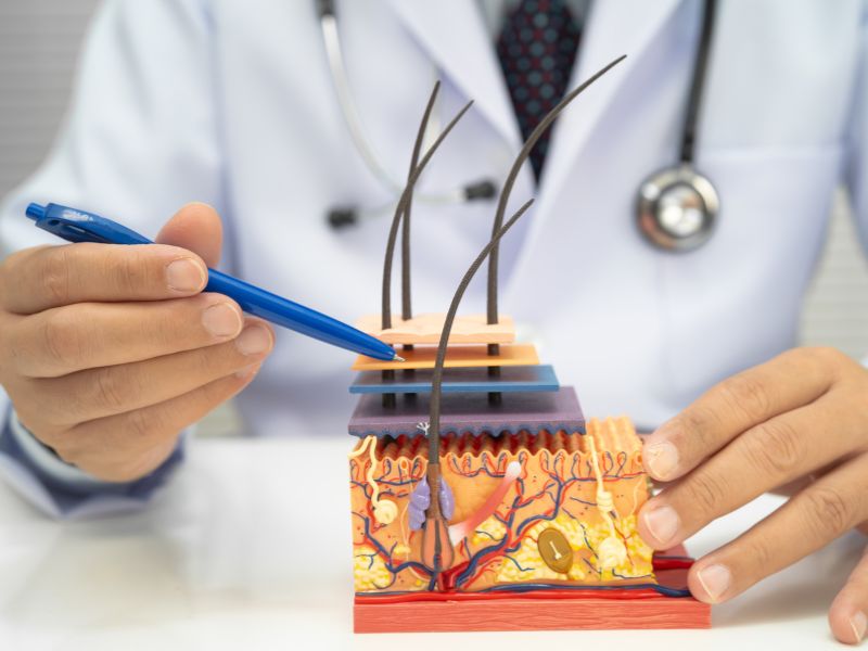 o que é bom para calvice masculina definitivo